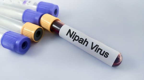 nipah-virus-1769918628490_169