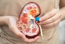 Gejala Kanker Ginjal yang Terlihat dari Urine, Waspadai Jika Mengalaminya