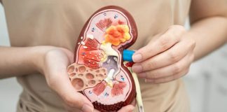 Gejala Kanker Ginjal yang Terlihat dari Urine, Waspadai Jika Mengalaminya