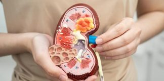 Terungkap Pemicu Terbesar Gagal Ginjal Makin Mengkhawatirkan di RI