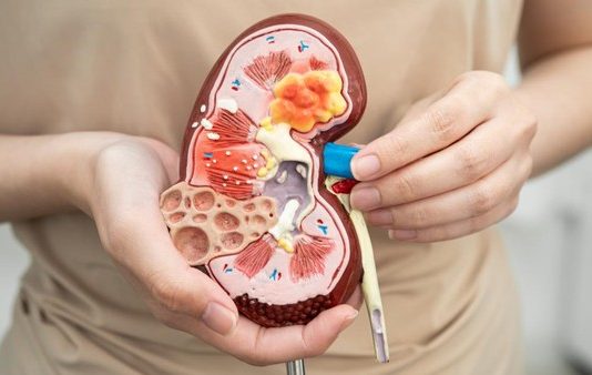 Terungkap Pemicu Terbesar Gagal Ginjal Makin Mengkhawatirkan di RI