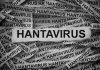 IDAI Imbau Tak Khawatir Soal Hantavirus, Masalah Difteri-Campak Lebih Darurat