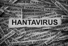IDAI Imbau Tak Khawatir Soal Hantavirus, Masalah Difteri-Campak Lebih Darurat