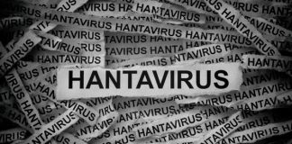 IDAI Imbau Tak Khawatir Soal Hantavirus, Masalah Difteri-Campak Lebih Darurat