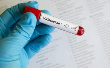 Ngeri! Wabah Kolera Hantui Nigeria, Kasus Tembus 12 Ribu-90 Orang Meninggal