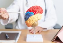 Agar Tak Salah Paham, Ini 5 Mitos Tumor Otak yang Perlu Diluruskan