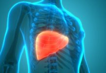 Usia 30-an Kini Banyak yang Kena Fatty Liver, Gejalanya Sering Terabaikan