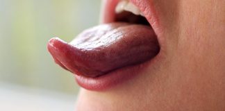 Sudah Pernah Cek? Perubahan di Lidah Seperti Ini Bisa Jadi Tanda Kolesterol Tinggi