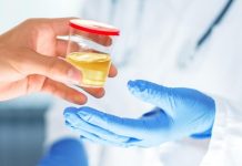 Viral Urine Berwarna Hijau, Apa Artinya? Ini Kata Urolog