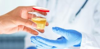 Viral Urine Berwarna Hijau, Apa Artinya? Ini Kata Urolog
